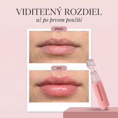 Lumea™ - Lip roller